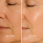 Before and after comparison of skin with fine lines, showing a reduction after 3 weeks of daily use.