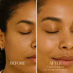 Before and after comparison of a woman's face with text indicating 3 weeks of daily use for skin tone improvement.